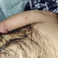 cmhle