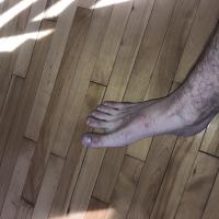 Servicemyfeet
