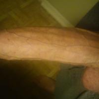 ThickUncutDripper