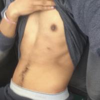 H